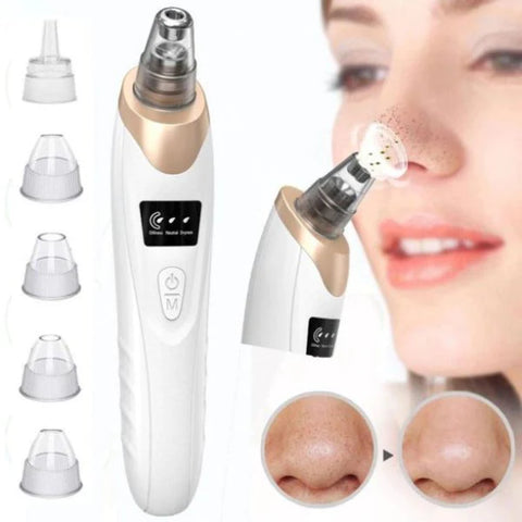 DermaSuction Pro: Electric Blackhead Instrument for Home Beauty - Pore-Cleaning